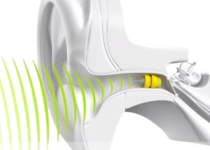 lyric hearing aid device